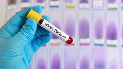 H5N1 influenza virus positive